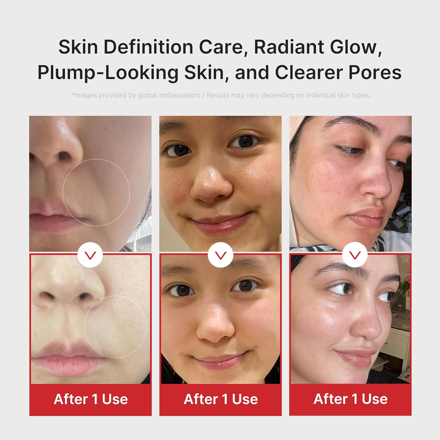 INIA Flare technology diagram showing surface mid and deep skin layer penetration vs other brands